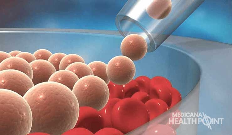 Bone Marrow Transplant